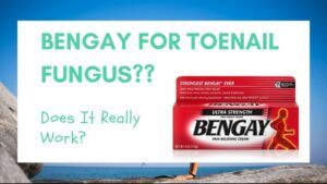 BENGAY for Toenail Fungus